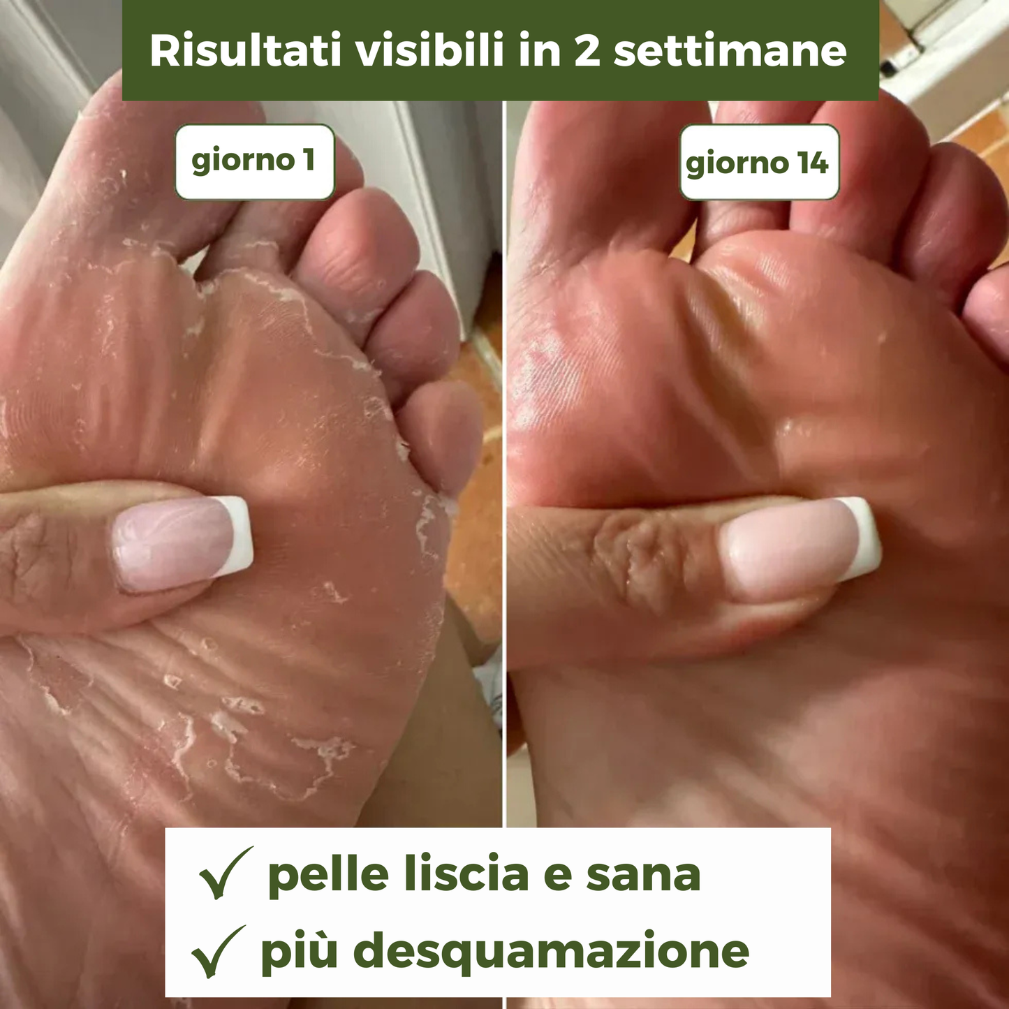 Sapone Antimicotico Verde™