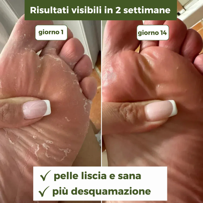 Sapone Antimicotico Verde™